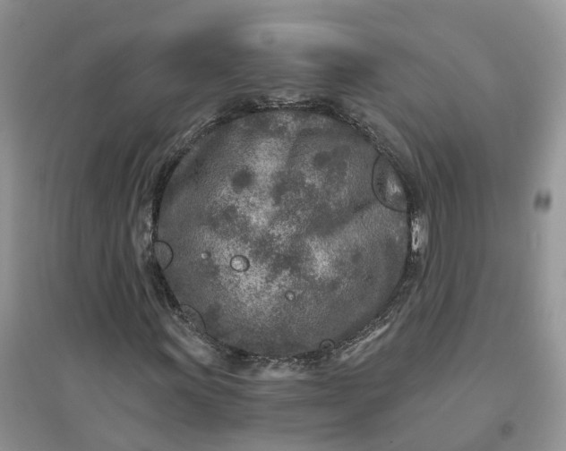 X0000096171011200802011313