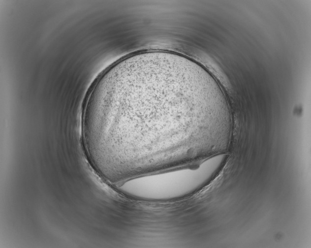 X0000096171036200802011314