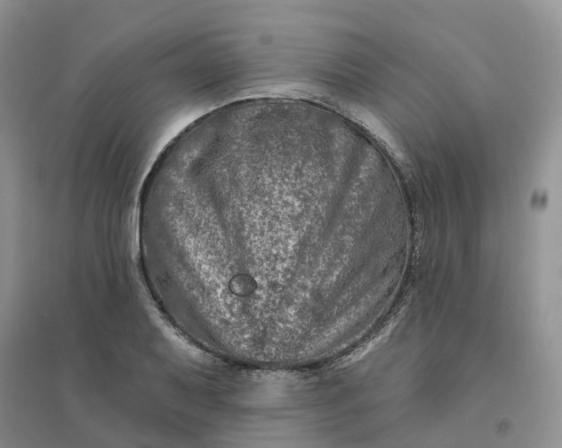 X0000096171079200802011313