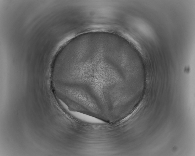 X0000096171411200802011308