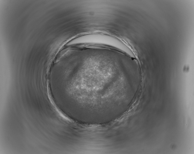 X0000096170097200802081420