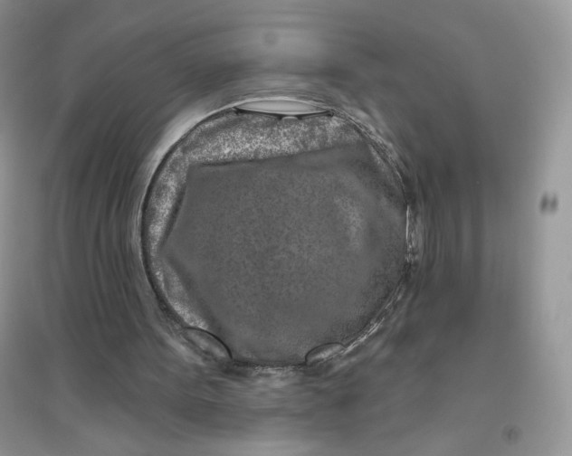 X0000096170099200802081420