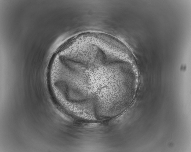 X0000096170151200802081419