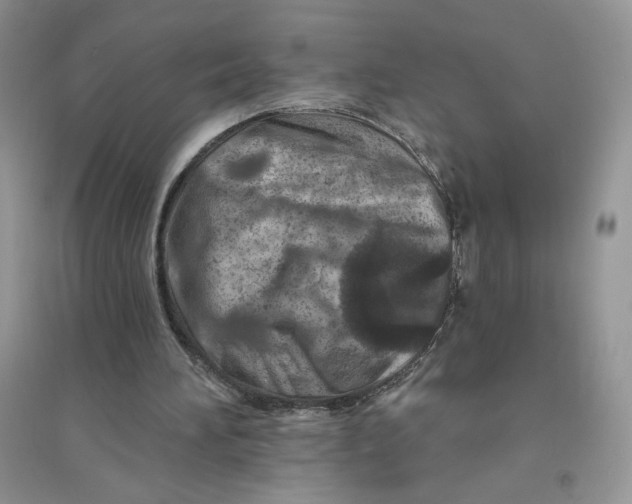 X0000096170196200802081419