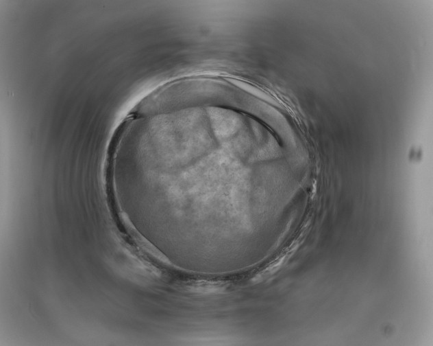 X0000096170292200802081417