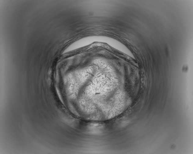 X0000096170319200802081417