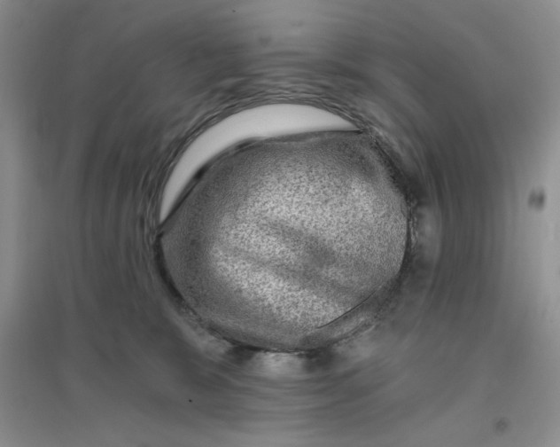 X0000096170327200802081417