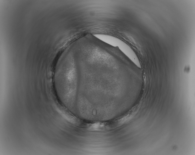 X0000096170366200802081417