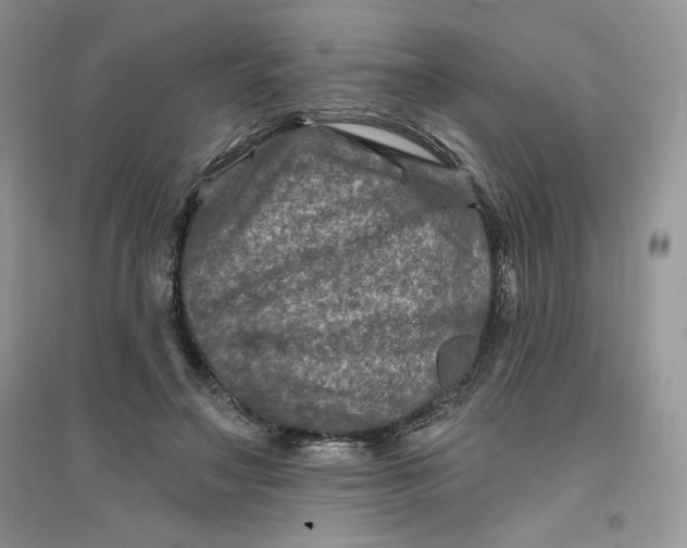 X0000096170499200802081414