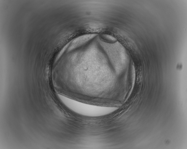 X0000096170647200802081412