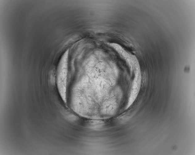 X0000096170719200802081411