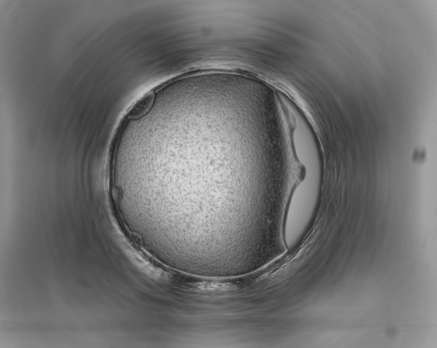 X0000096170795200802081410