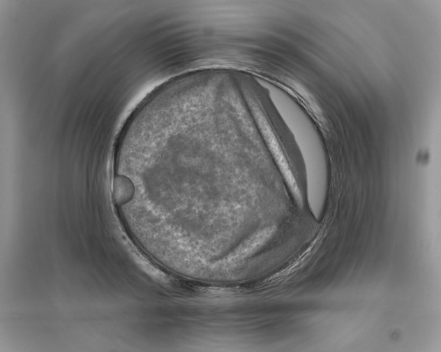 X0000096170796200802081410