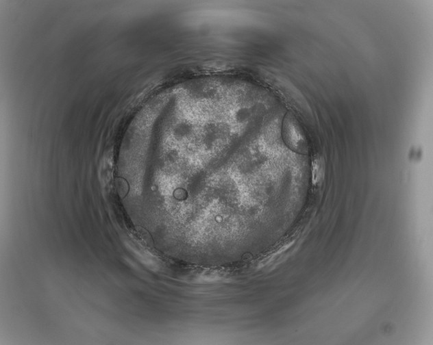 X0000096171011200802081406