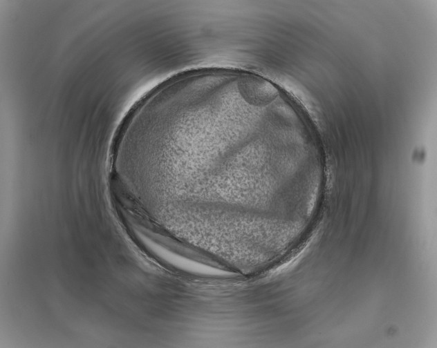 X0000096171077200802081406