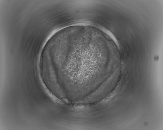 X0000096171099200802081405