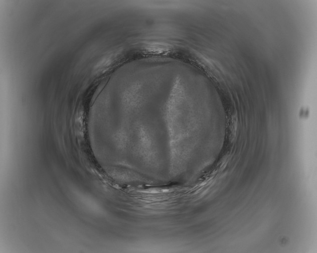 X0000096171394200802081400