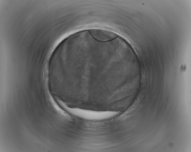 X0000096171515200802081359