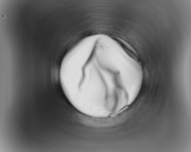 X0000096170042200802151443
