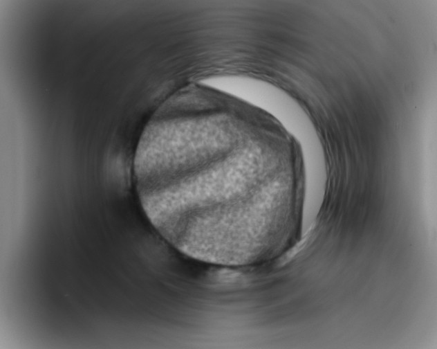 X0000096170180200802151442