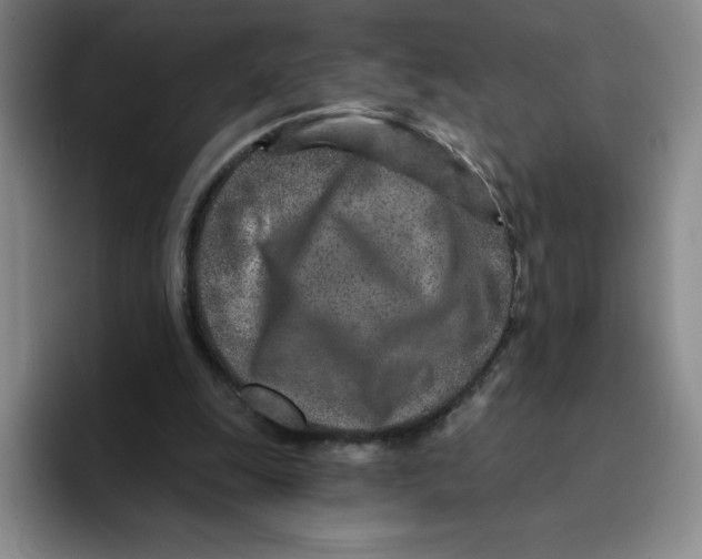 X0000096170247200802151440