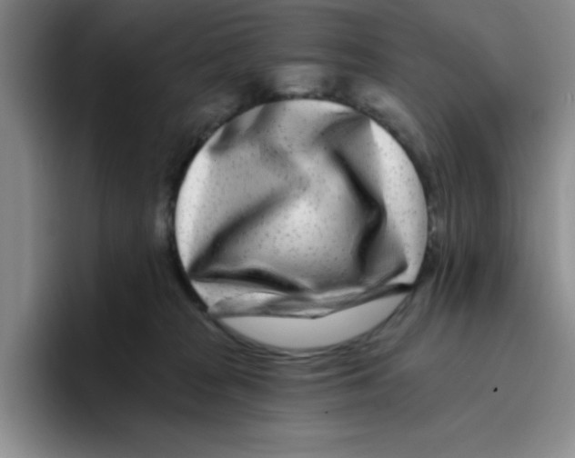 X0000096170277200802151441