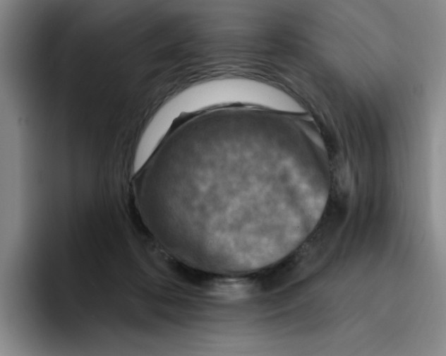 X0000096170316200802151440
