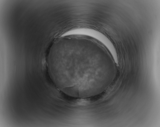 X0000096170320200802151440