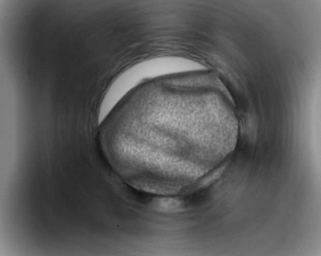 X0000096170327200802151440