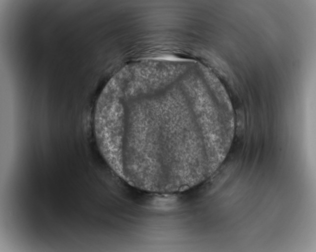 X0000096170369200802151439