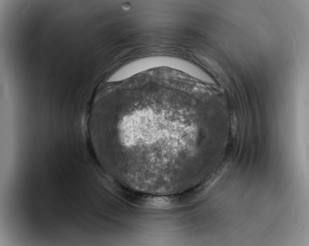 X0000096170409200802151439