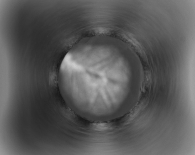 X0000096170419200802151438