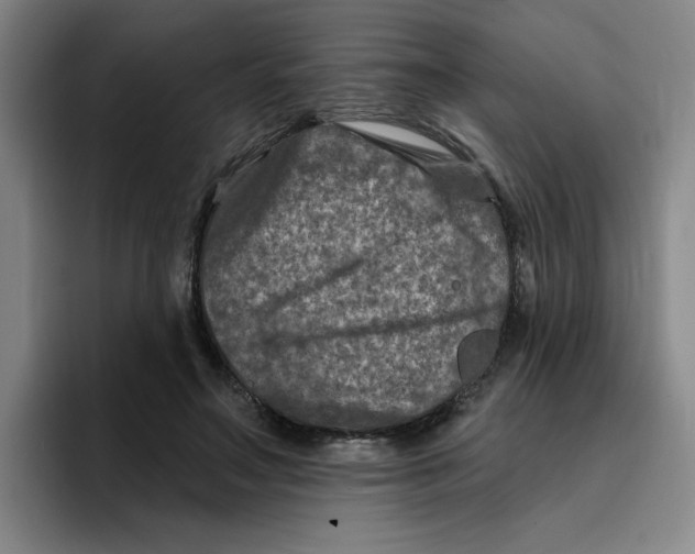 X0000096170499200802151437