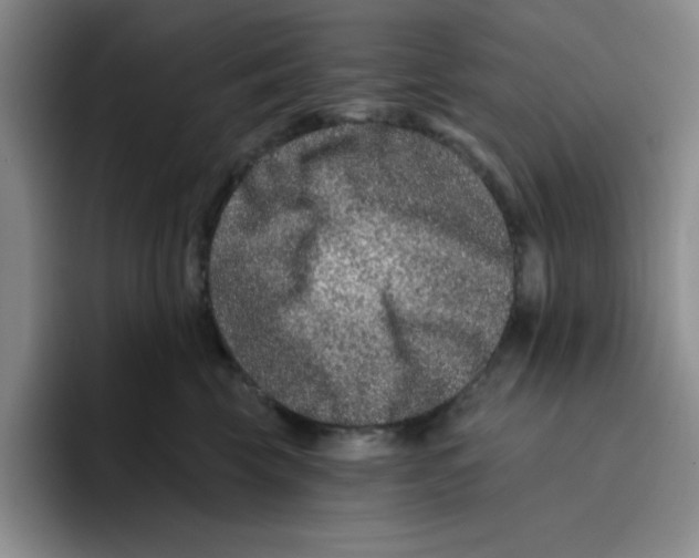 X0000096170569200802151437
