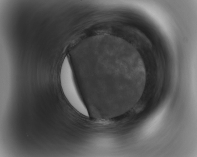 X0000096170767200802151435