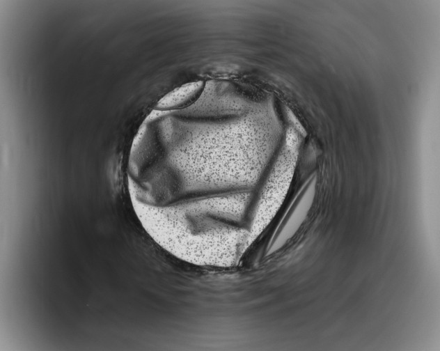 X0000096170818200802151433
