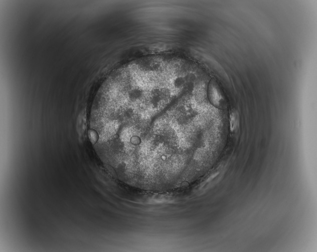 X0000096171011200802151430
