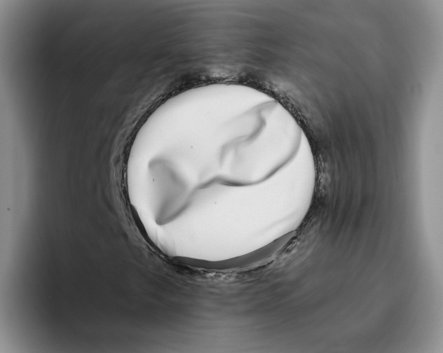 X0000096171249200802151428