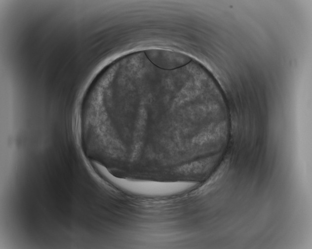 X0000096171515200802151424