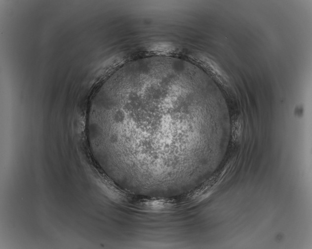 X0000096180365200801181317