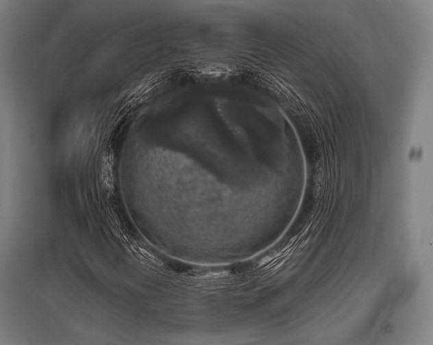 X0000096181394200801181302