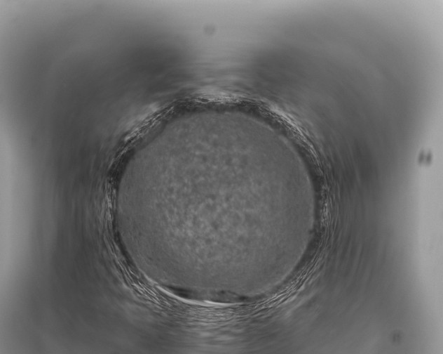 X0000096181397200801251204