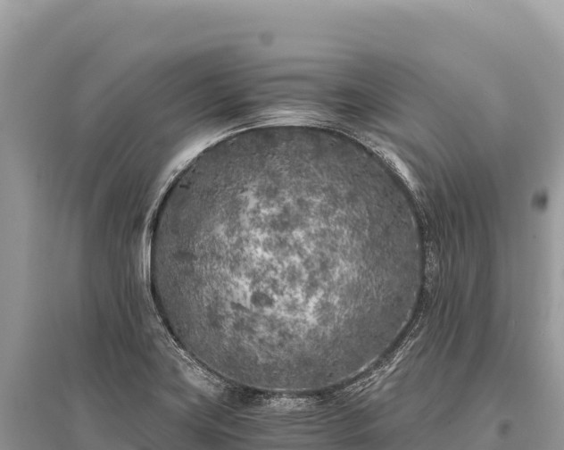 X0000096181419200801251205