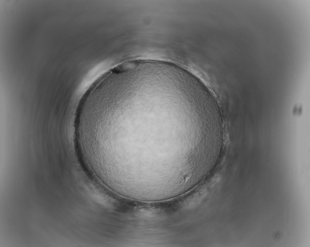 X0000096180199200802011351