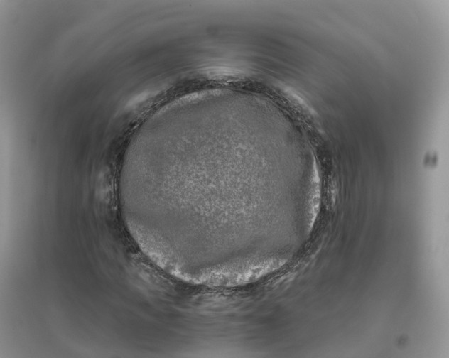 X0000096180917200802011338