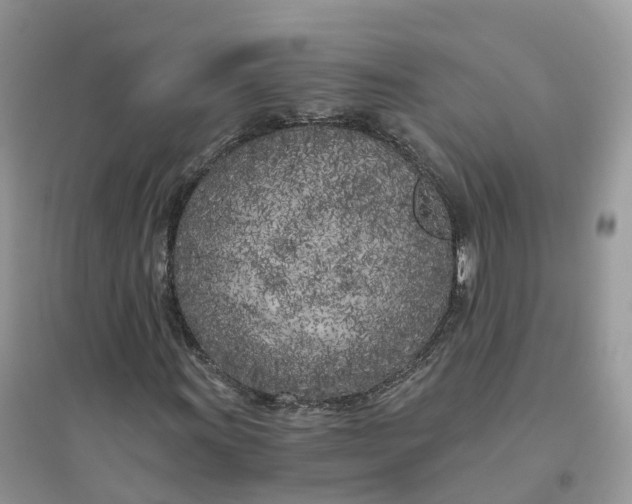 X0000096181011200802011337