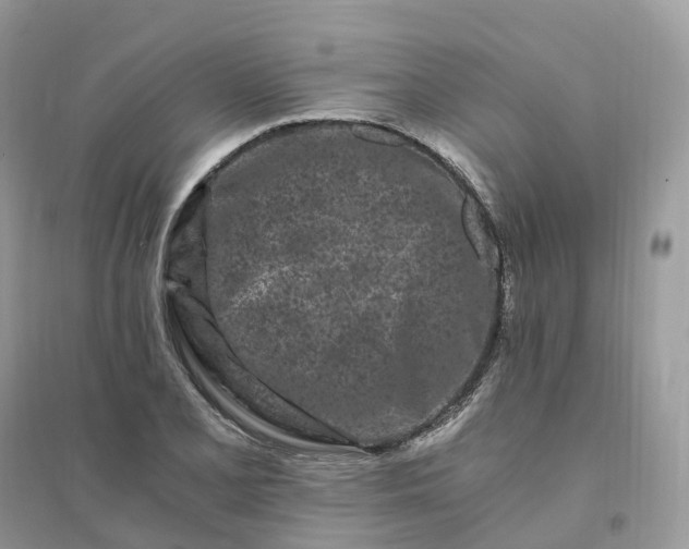 X0000096181077200802011336