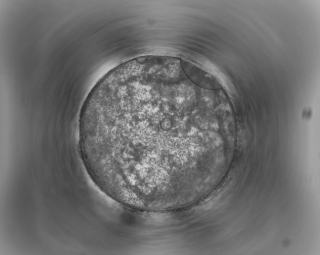 X0000096181095200802011336