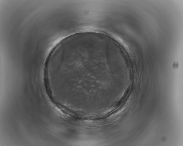 X0000096181463200802011331