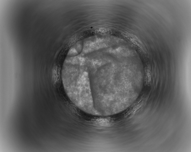 X0000096180236200802081506